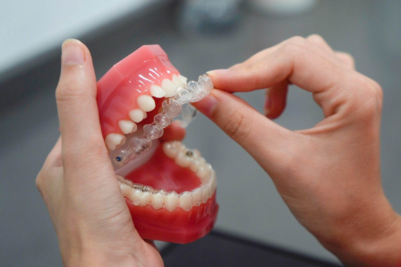 invisalign set